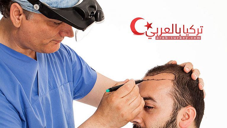 زراعة-الشعر
