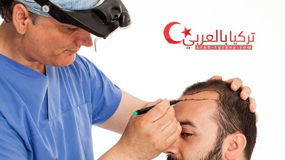 زراعة الشعر في تركيا