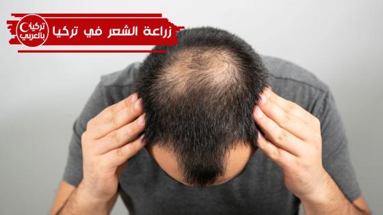 زراعة الشعر في تركيا