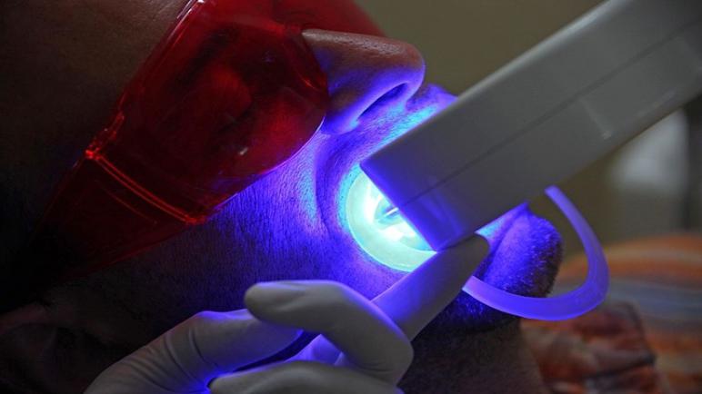 باحثون أتراك يطورون تقنية جديدة لزراعة الأسنان “تبتلع” زمن الشفاء