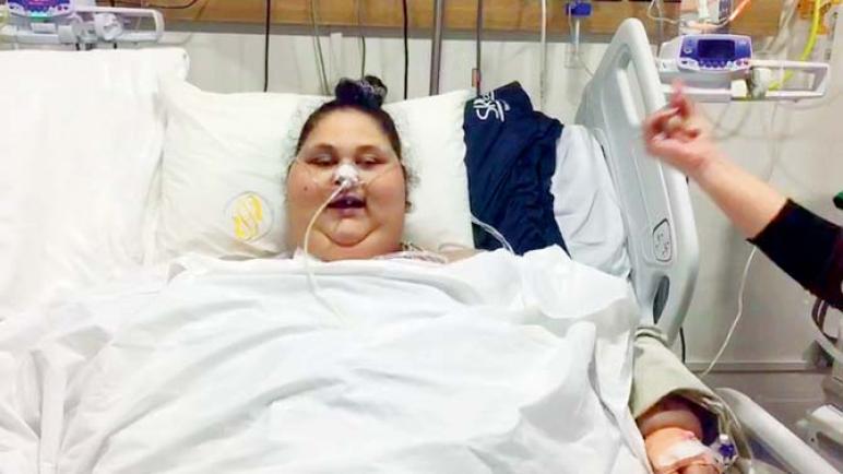 أثقل امرأة في العالم” والتي فقدت 250 كيلوغراما تدخل مستشفى في الإمارات للعلاج