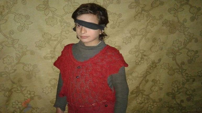 حلا طفلة سورية قد تفقد بصرها لعدم قدرة أهلها دفع تكاليف العلاج!!
