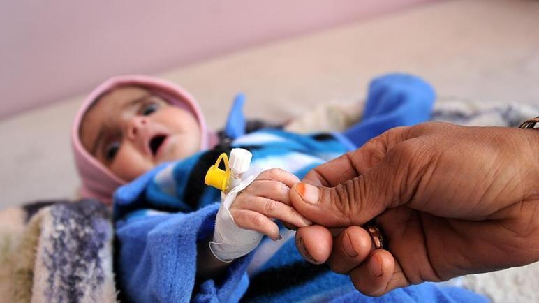 منظمة الصحة العالمية: الكوليرا تتفشى بـ18 محافظة يمنية